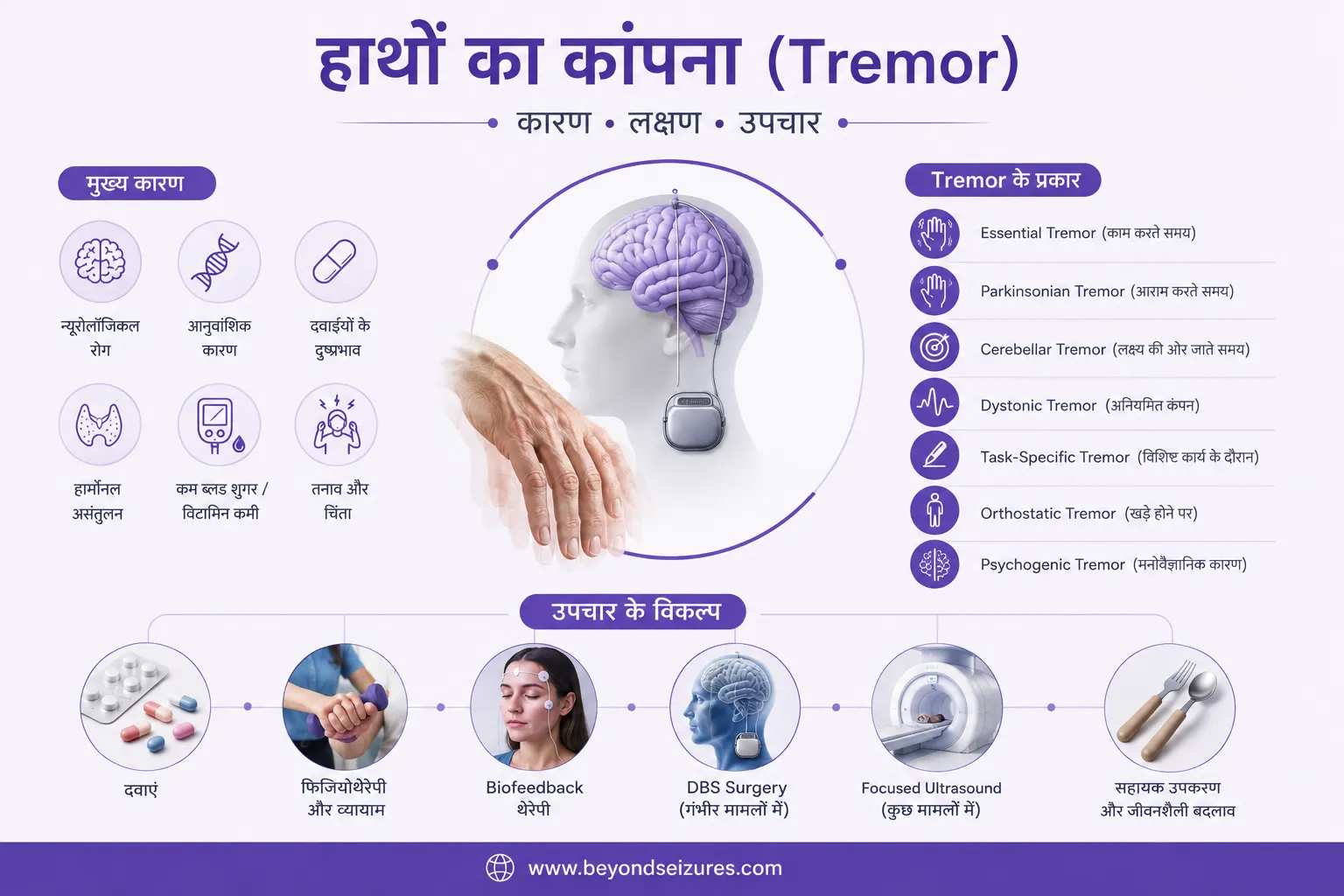 Minimal medical infographic explaining hand tremor (Tremor) in Hindi with a central brain and DBS illustration, shaking hand visual, icons showing common causes, different tremor types including Essential Tremor and Parkinsonian Tremor, and treatment options such as medication, physiotherapy, biofeedback, Focused Ultrasound, and DBS Surgery on a clean white and purple background.