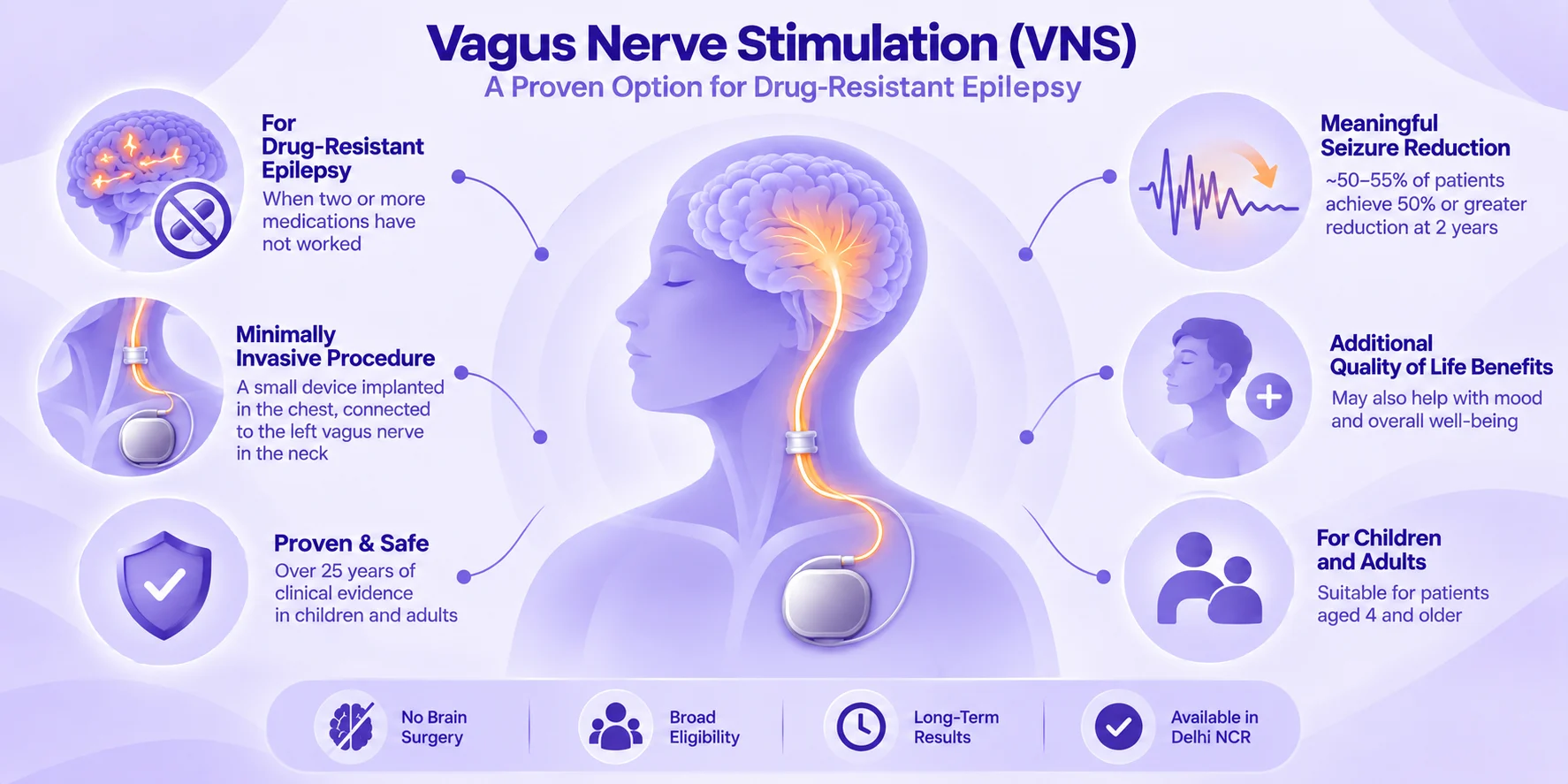 Vagus nerve stimulation (VNS) therapy for drug-resistant epilepsy, showing the implanted vagus nerve stimulator and key treatment benefits.